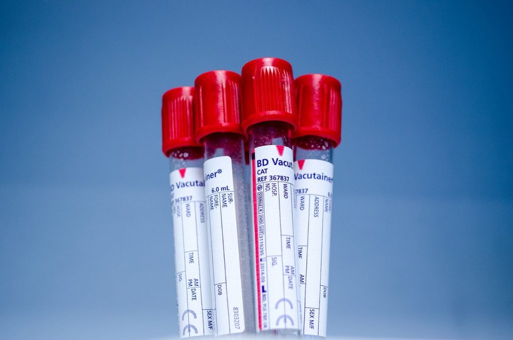 Blutprobe wird im Labor ausgewertet